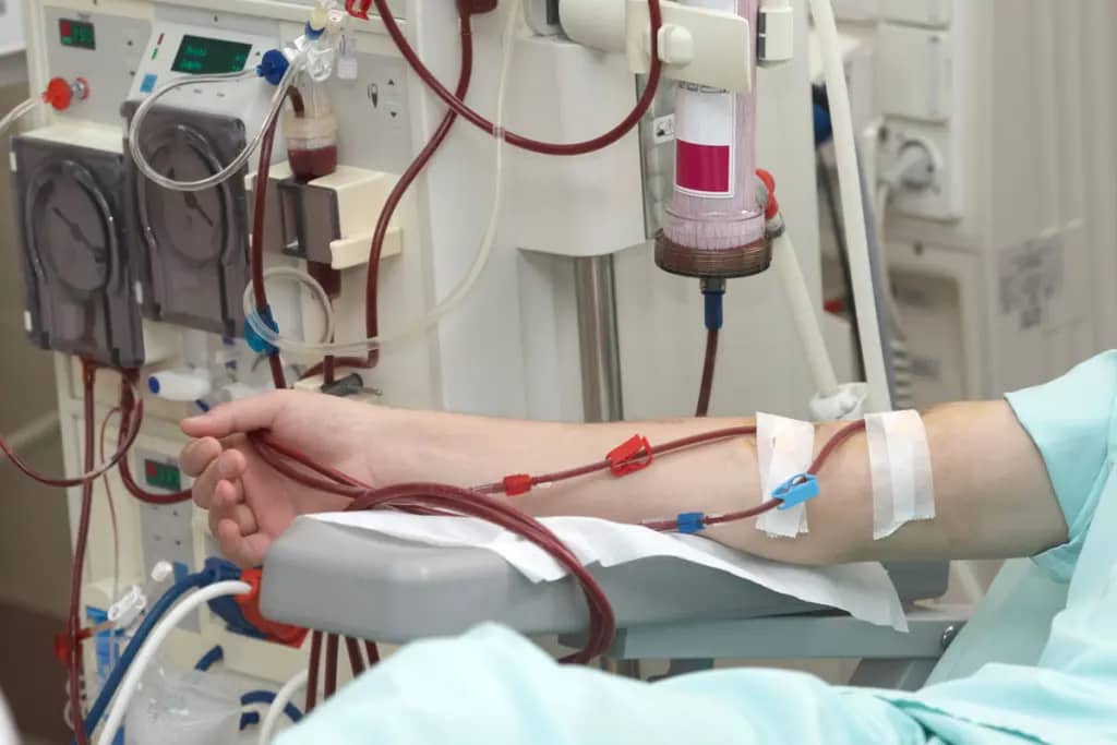 Dialysis-Care | Best Facility & Well Equipped Hospital In Lucknow - Sanjivini